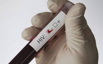 Тестування на ВІЛ-інфекцію