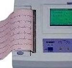 Електрокардіографія: можливості методу та покази до проведення