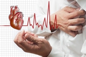 Інфаркт міокарда: історичні аспекти