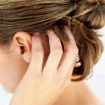 Клінічні прояви псоріазу волосистої частини голови