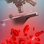 Новітні фізичні методи дослідження крові