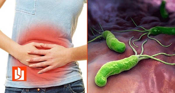 лікування та профілактики Н.pylori-асоційованих захворювань шлунку та ДПК