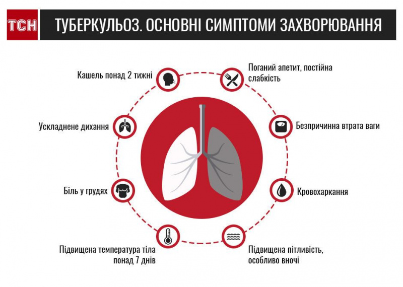 Чи можна помилитися з діагнозом туберкульоз?