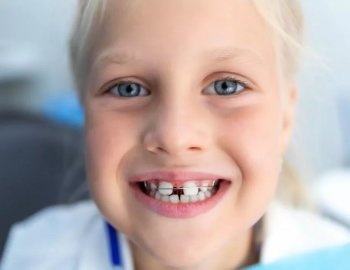 Діастема зубів у дітей: причини і лікування