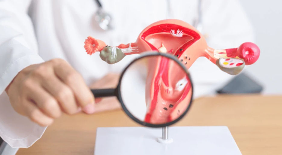 Рак шийки матки: патологія, яку можна попередити